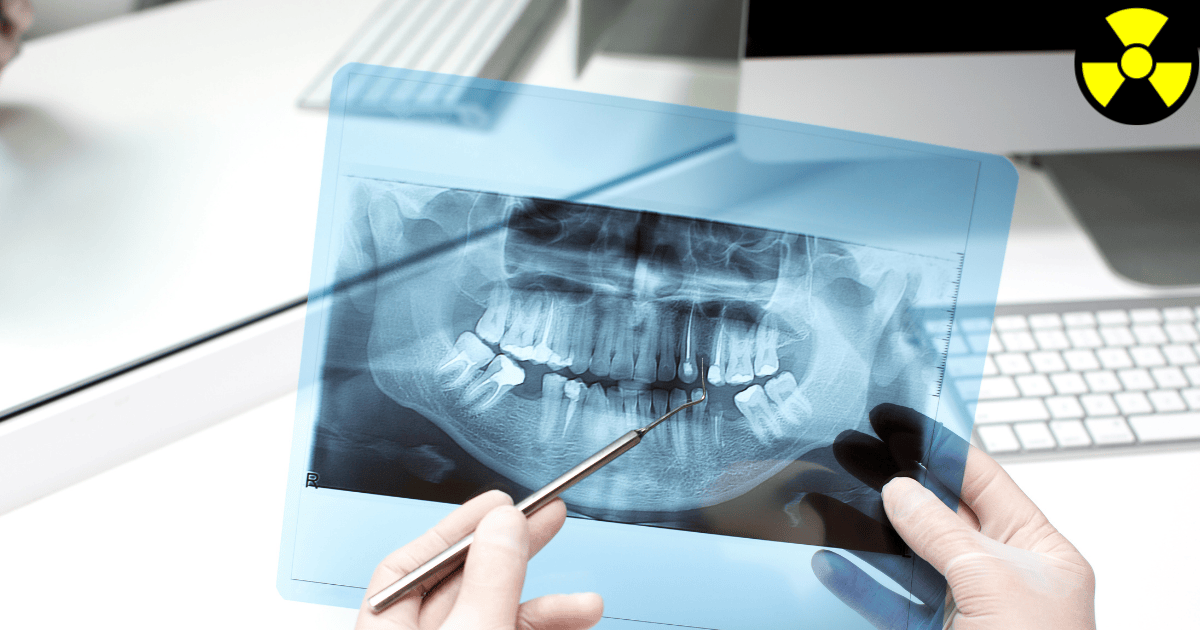 Kurs Ochrona Radiologiczna Pacjenta Lekarze Stomatolodzy LST